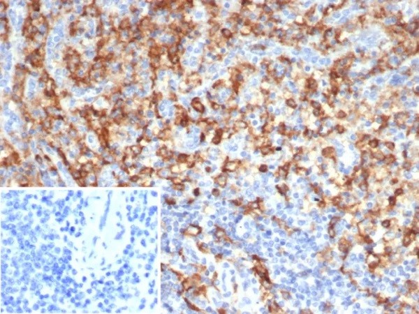 CD33 / SIGLEC3 (Myeloid Cell Surface Antigen); Clone SIGLEC3/7612