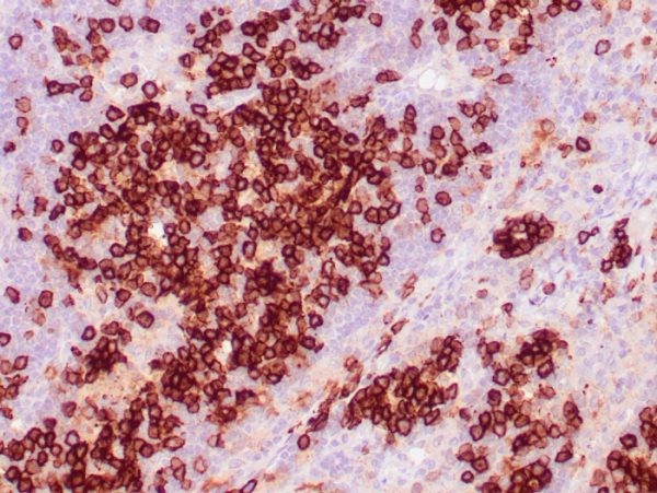 CD38 (ADP Ribosyl Cyclase I); Clone CD38/4328
