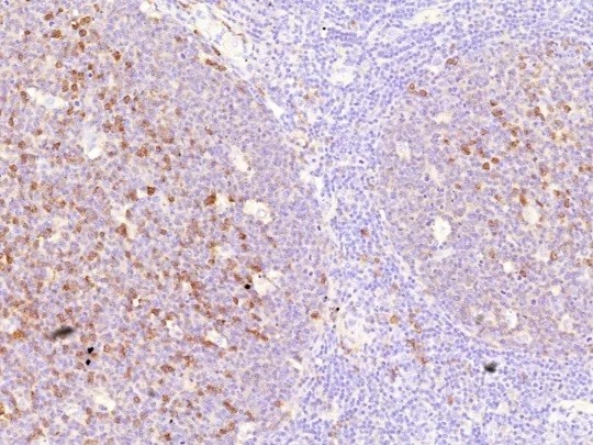 CD38 (ADP Ribosyl Cyclase I); Clone CD38/9332