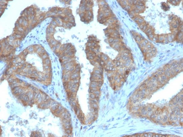 CD47 / IAP (Integrin Associated Protein); Clone CD47/3019