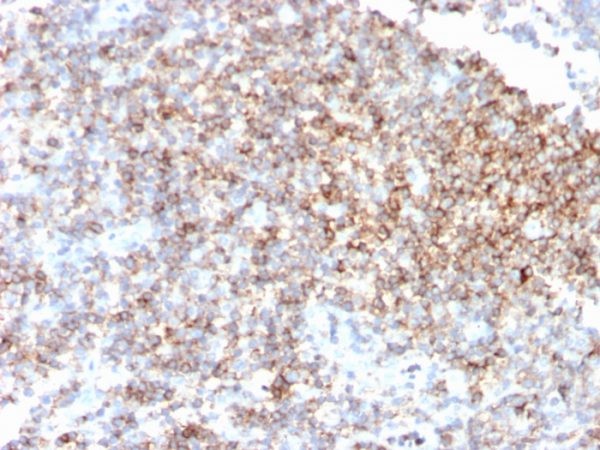CD48 (Pan Leukocyte Marker); Clone CD48/4785