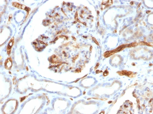 Adiponectin (Marker of Obesity); Clone ADPN/1370