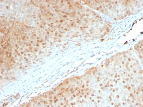 AKT1 (Prognostic Marker for Neuroendocrine Tumors); Clone AKT1/2552