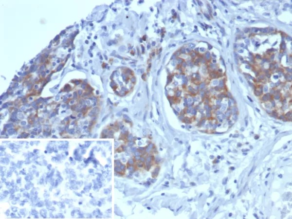 AMBP (Alpha 1 Microglobulin) / Bikunin; Clone AMBP/4533