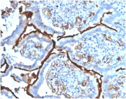 Angiotensin I Converting Enzyme (ACE) / CD143; Clone ACE/3764