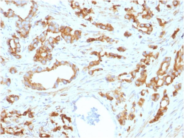 Aurora B (Proliferation Marker); Clone AURKB/1593