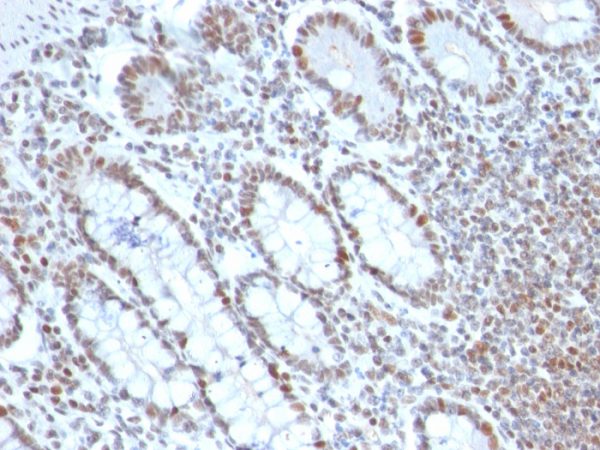 BMI1 (Oncogene and Stem Cell Marker); Clone BMI1/2690