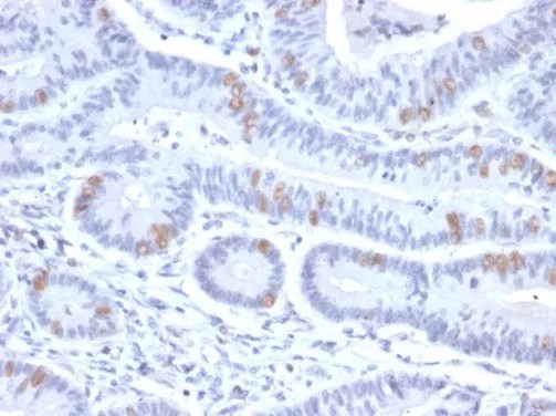 BRAF35 / HMG20B; Clone PCRP-HMG20B-1B5