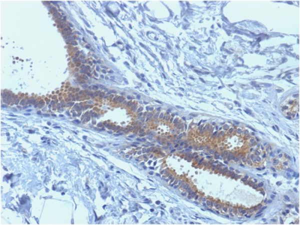 BRCA1 (Breast Marker); Clone BRCA1/1398