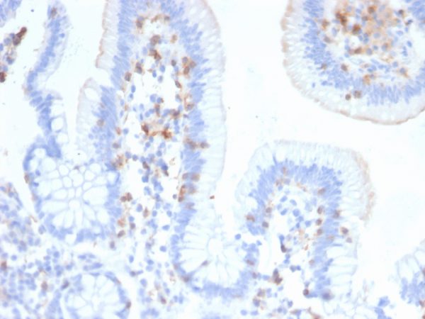 CD103 / Integrin alpha E (T-Cell Lymphoma & Hairy Cell Leukemia Marker); Clone ITGAE/2474