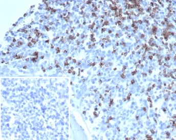 CD2 / Lymphocyte Function Antigen 2 (LFA-2); Clone LFA2/7100