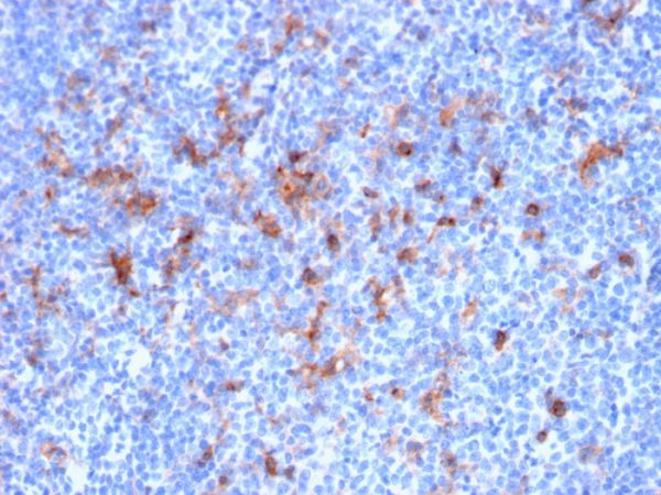 CD25 / IL2RA (Activated Lymphocyte Marker); Clone IL2RA/2395