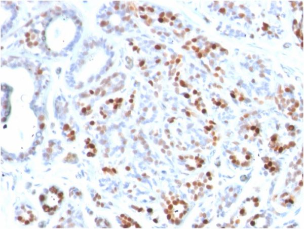 GATA-3 (Breast and Urothelial Marker); Clone GATA3/2444