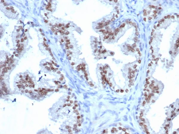 Recombinant NKX3.1 (Metastatic Prostate Adenocarcinoma Marker); Clone rNKX3.1/6620
