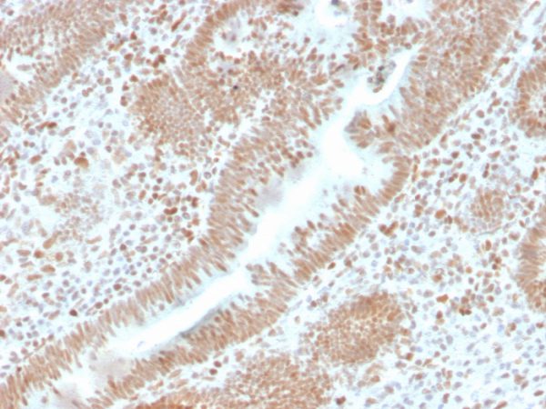 Recombinant PMS2 (Postmeiotic Segregation Increased 2); Clone PMS2/4373R