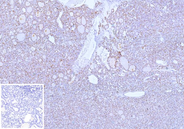 PAX8 (Renal Cell Marker); Clone PAX8/12570