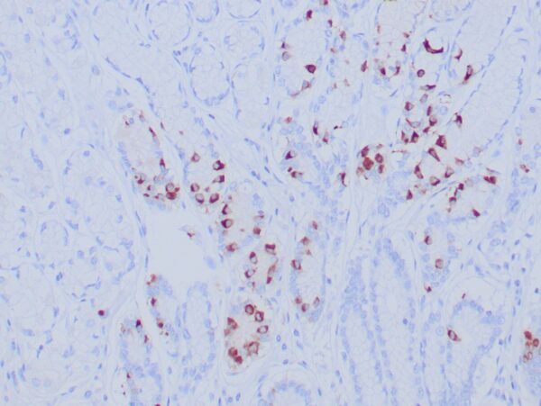 Recombinant Gastrin; Clone GAST/8646R