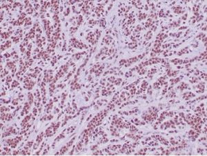 Recombinant Integrase interactor 1 (INI-1) / SNF5 / SMARCB1; Clone SMARCB1/4587R
