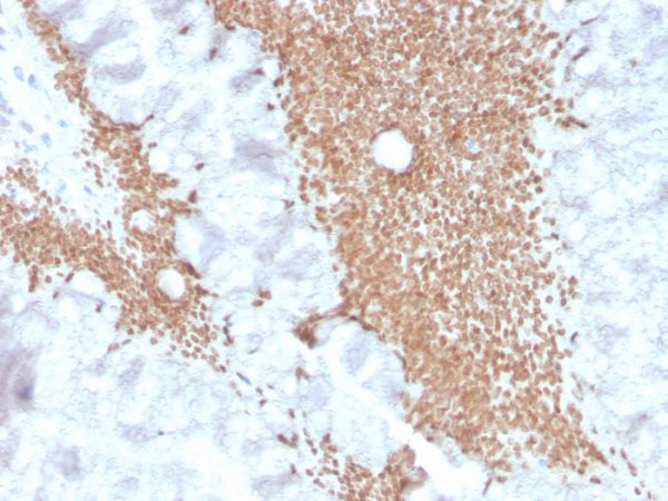 Recombinant SATB2 (Colorectal Carcinoma Marker); Clone SATB2/4374R