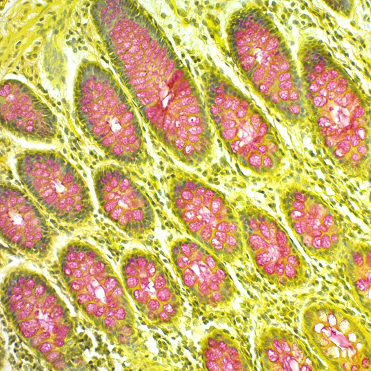 Mucicarmine Solution (Southgate's)