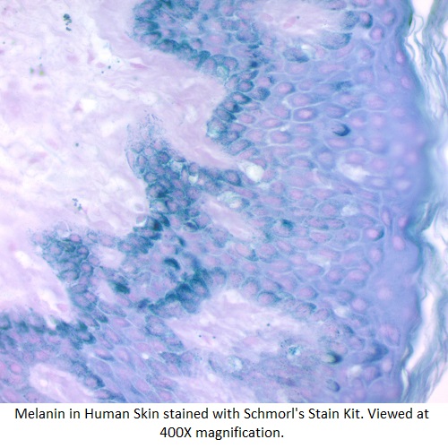 Schmorl's Stain Kit