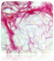 Picro-Sirius Red Stain Kit (For Cardiac Muscle)