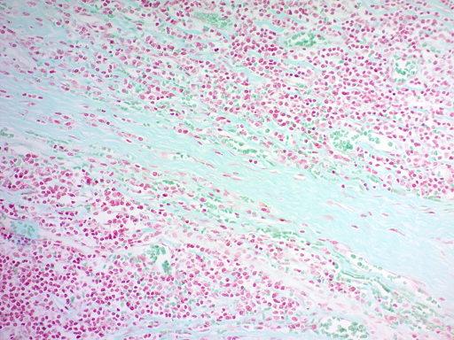 Twort's Counterstain Kit