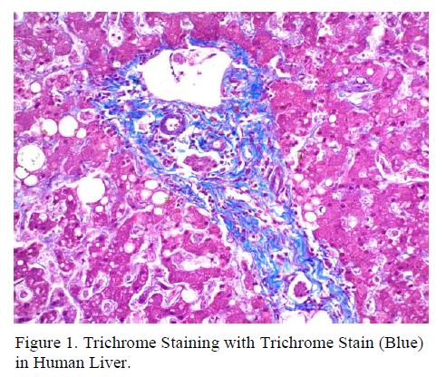 Trichrome Stain (Blue)