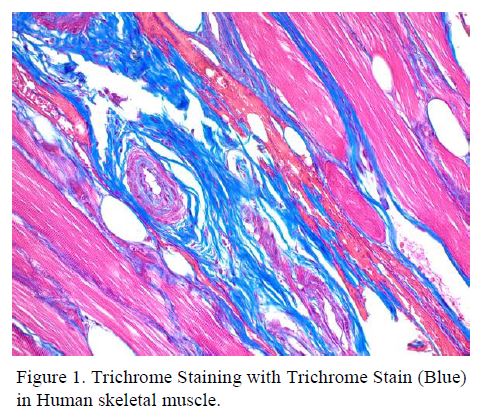 Trichrome Stain (Blue)