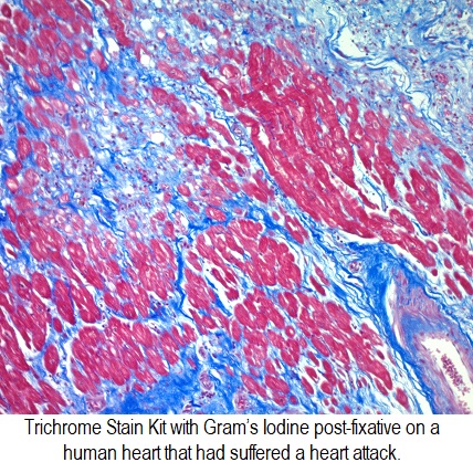 Trichrome Stain Kit (with Iodine)