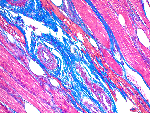 Trichrome Stain Kit (Modified Gomori's)