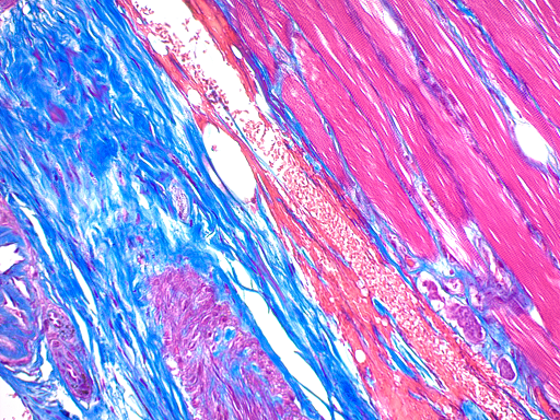 Trichrome Stain Kit (Modified Gomori's)