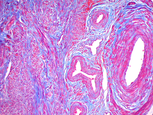 Trichrome Stain Kit (Modified Masson's)