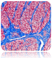 Trichrome Stain Kit (Modified Masson's)