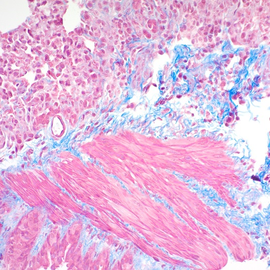 Trichrome Stain Kit (Modified Masson's)